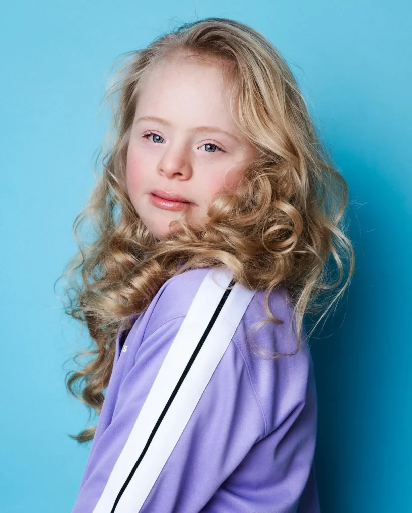 Romy | Breaking Beauty Standards