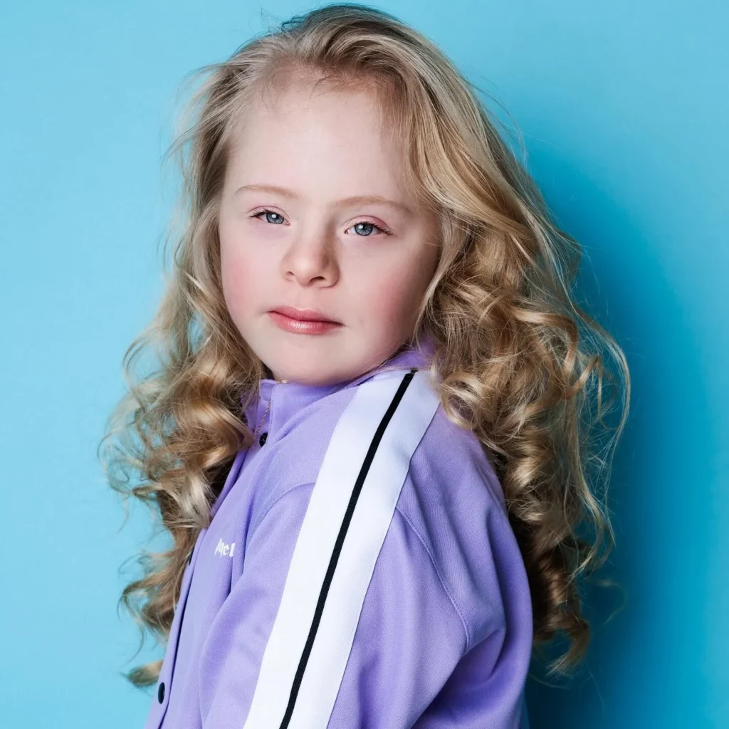 Romy | Breaking Beauty Standards