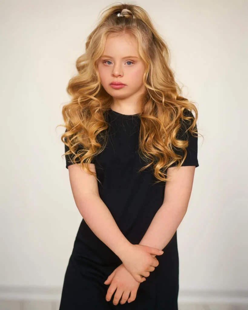 Romy | Breaking Beauty Standards