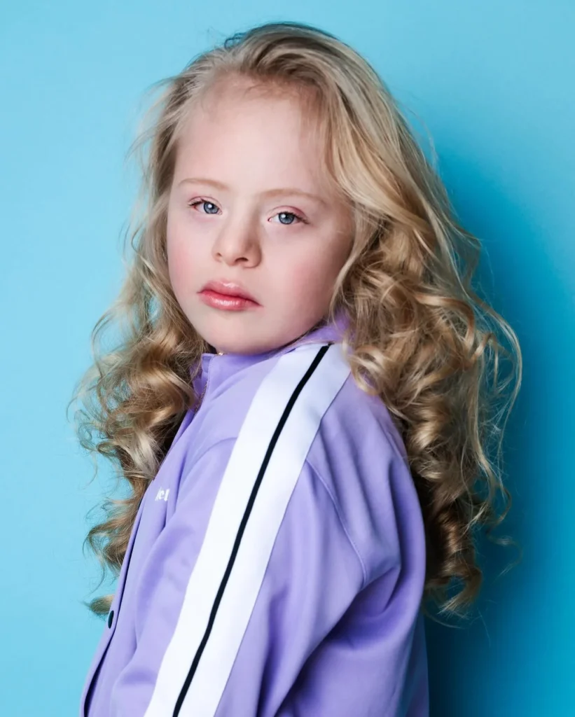Romy | Breaking Beauty Standards