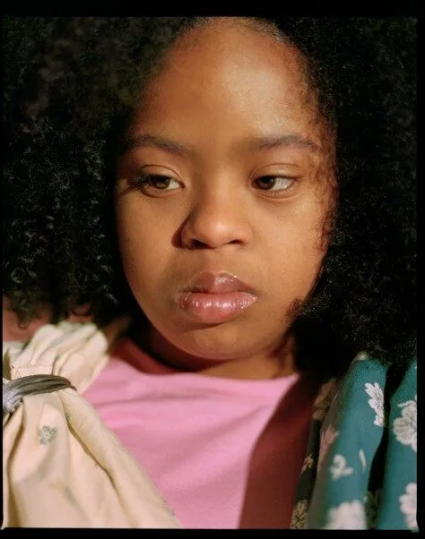Close up of a kids model with downsyndrome looking away from the camera